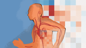 Cardiovascular Machine Learning